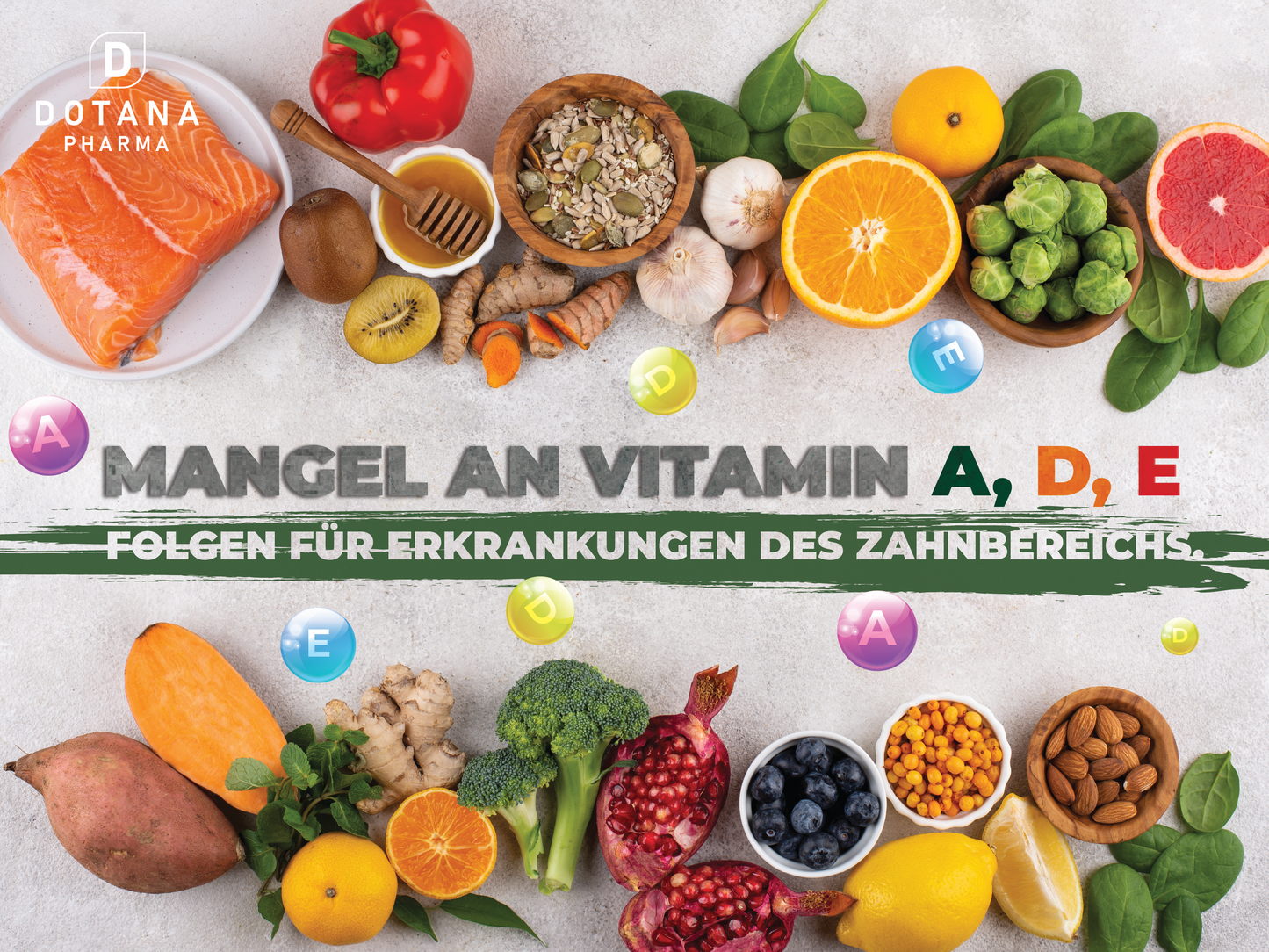 Vitamin-A-, D- und E-Mangel – Folgen für parodontale Erkrankungen